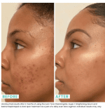 Urban Skin Rx Even Tone Cleansing Bar - Image 2